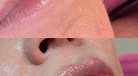 Close-up of glossy lips after a beauty treatment at Nu Face Clinic, Worsley, England, GB.