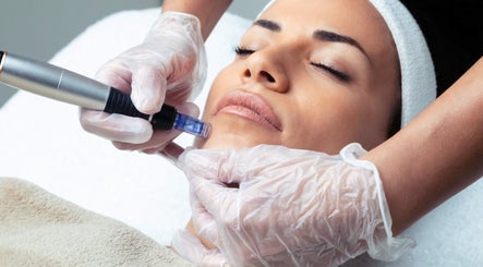 Facial treatment at LNLaesthetics, Addlestone, England, GB showcasing microneedling for skin rejuvenation.