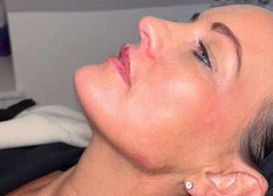 Profile of a woman with radiant skin after a facial treatment at So Chlo Cosmetics, Airdrie, Scotland, GB.