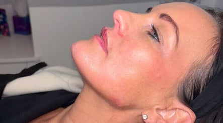 Profile of a woman with radiant skin after a facial treatment at So Chlo Cosmetics, Airdrie, Scotland, GB.