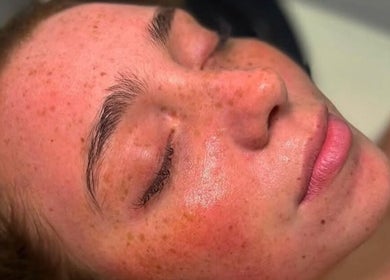 Close-up of a serene face post-facial at So Chlo Cosmetics, Airdrie, Scotland, GB, showcasing radiant skin.