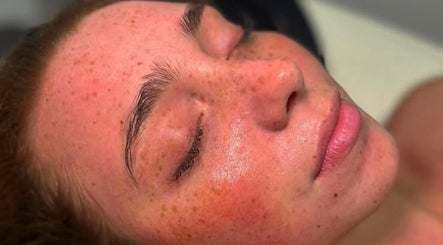 Close-up of a serene face post-facial at So Chlo Cosmetics, Airdrie, Scotland, GB, showcasing radiant skin.