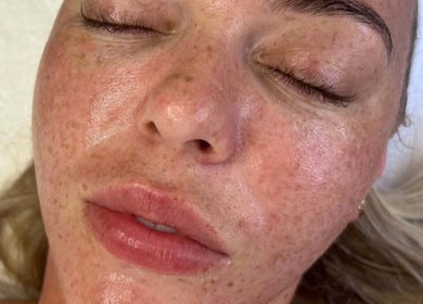 Close-up of a glowing facial treatment at Glow&co. Skin Lab, Stockton-on-tees, England, GB.