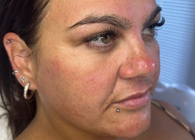 Close-up of glowing skin post-treatment at Glow&co. Skin Lab, Stockton-on-tees, England, GB.