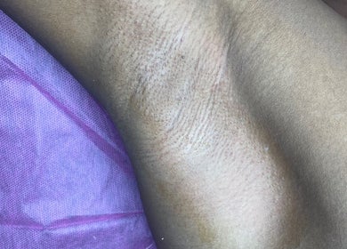 Close-up of smooth skin after treatment at B’s Beauty Room, Sangre Grande, Sangre Grande Regional Corporation, TT.