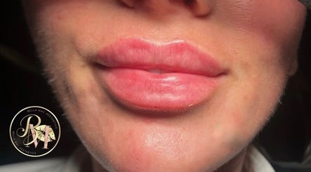 Bella Mac Aesthetics Alderley Edge image 2