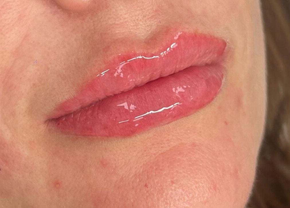 Close-up of glossy lips treatment at Angel Aesthetics in Lincoln, England, GB.