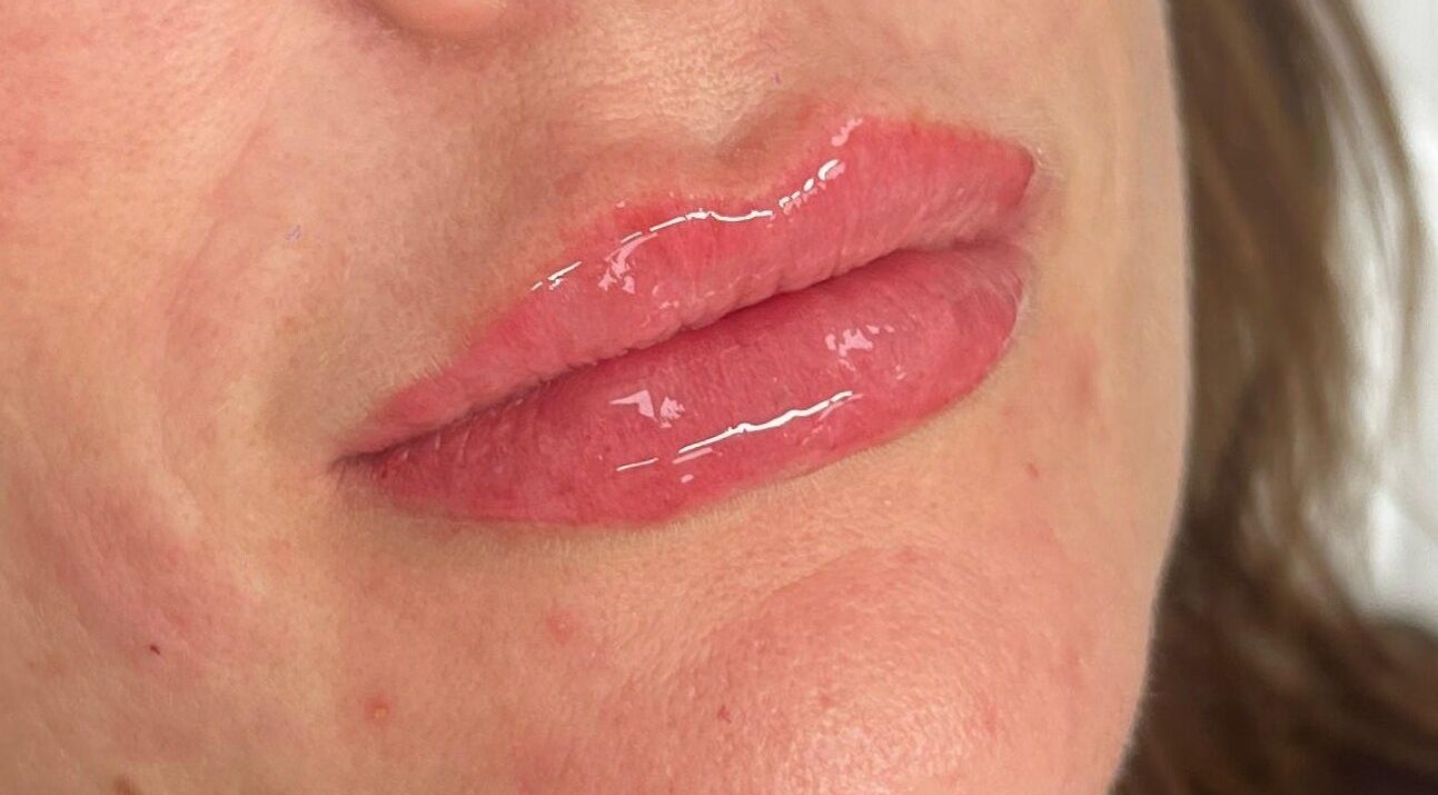 Close-up of glossy lips treatment at Angel Aesthetics in Lincoln, England, GB.