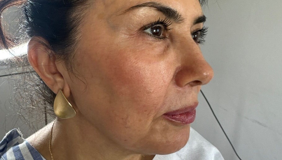 Close-up of a woman's profile at A Class Beauty & Pmu Academy, London, England, GB showcasing radiant skin.