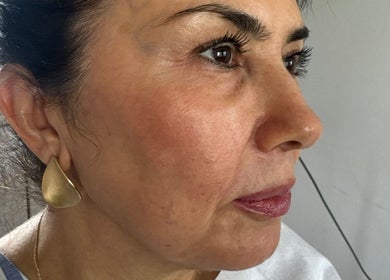 Close-up of a woman's profile at A Class Beauty & Pmu Academy, London, England, GB showcasing radiant skin.