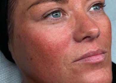 Close-up of a client's radiant skin after treatment at Angel Eyes by Beth, Crook, England, GB.