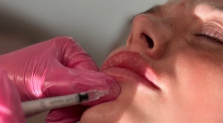 Lip enhancement procedure at You’re Lit Clinic in Snodland, England, GB. Pink-gloved practitioner in action.