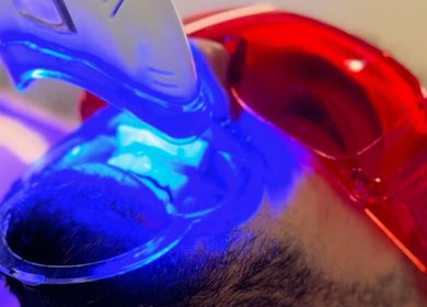 LED light therapy at You’re Lit Clinic, Snodland, England, GB enhancing skin health.