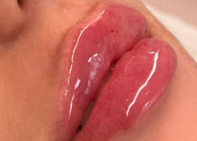 Close-up of glossy lip enhancement at You’re Lit Clinic, Snodland, England, GB.