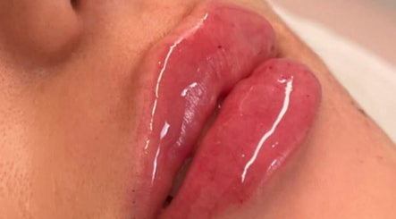 Close-up of glossy lip enhancement at You’re Lit Clinic, Snodland, England, GB.