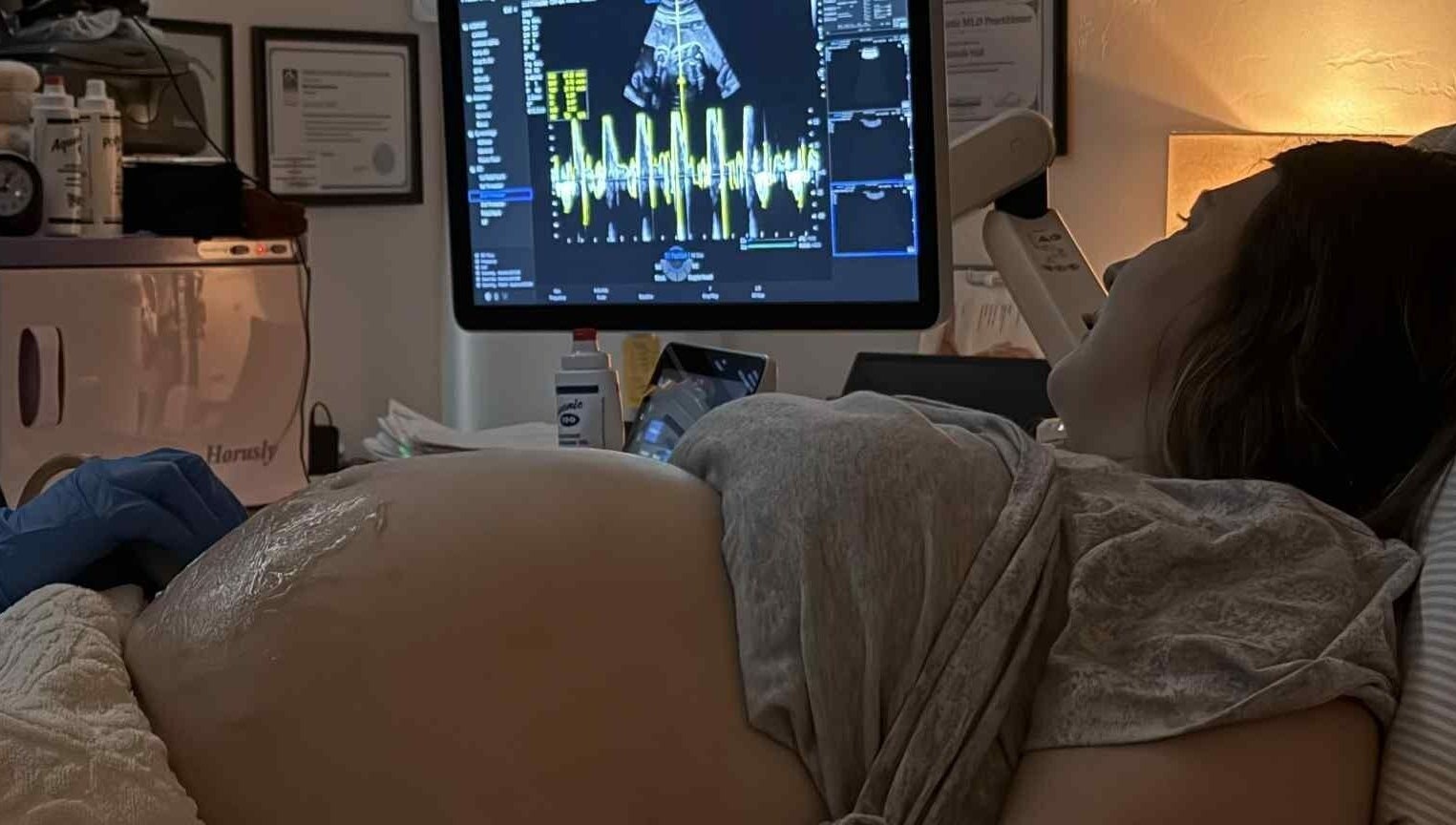 Pregnancy ultrasound at Sunbeam Sonogram, De Pere, Wisconsin, US, displaying sonogram screen.