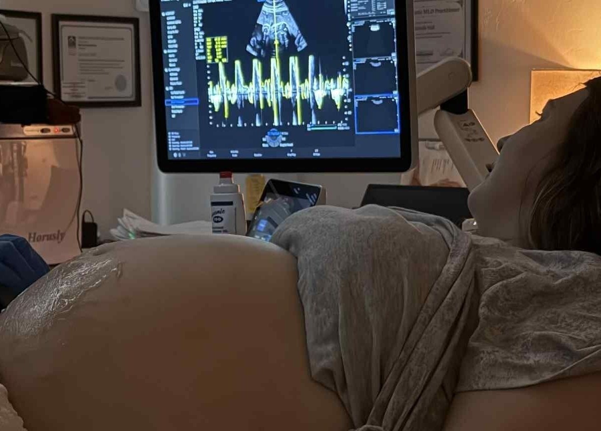 Pregnancy ultrasound at Sunbeam Sonogram, De Pere, Wisconsin, US, displaying sonogram screen.