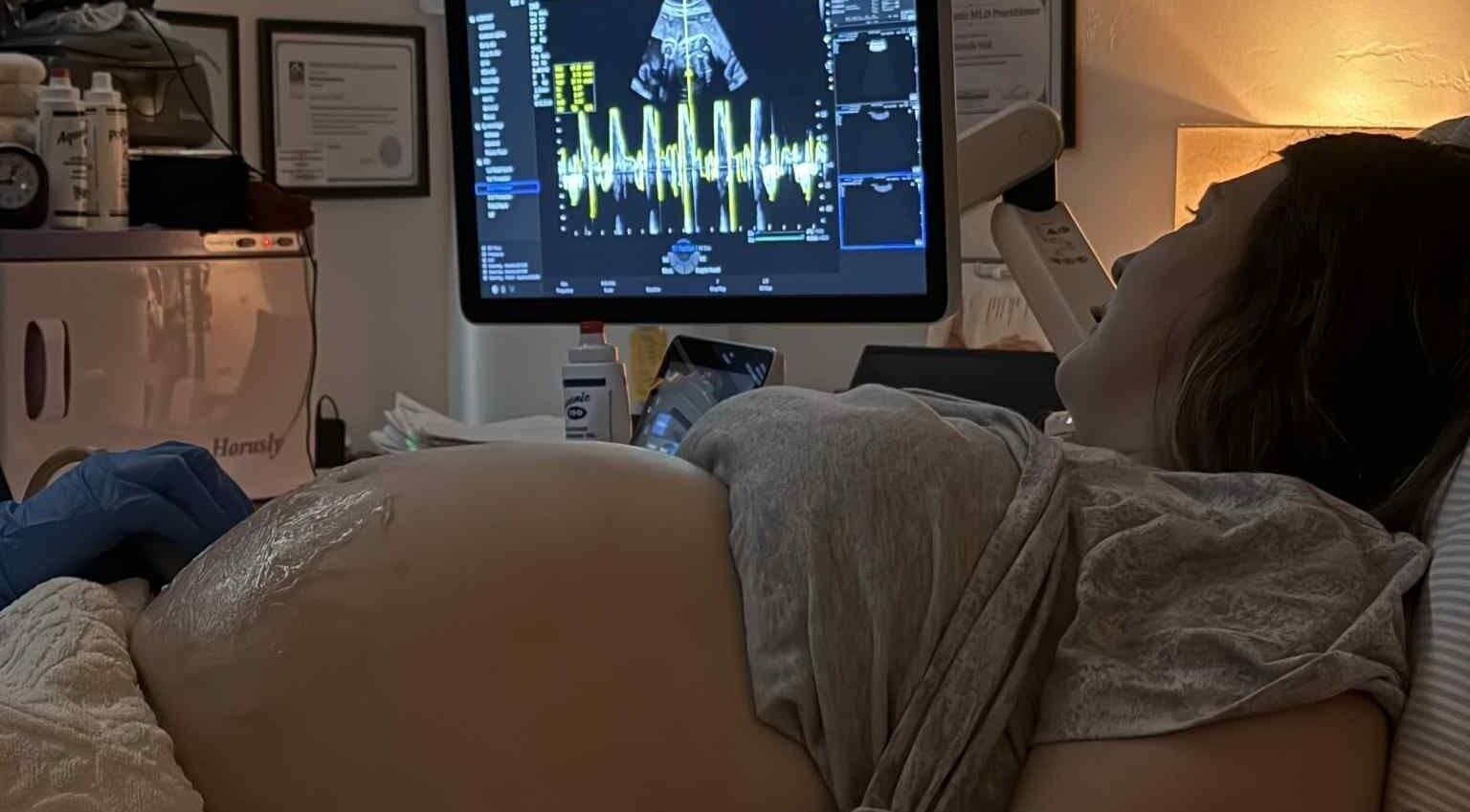 Pregnancy ultrasound at Sunbeam Sonogram, De Pere, Wisconsin, US, displaying sonogram screen.