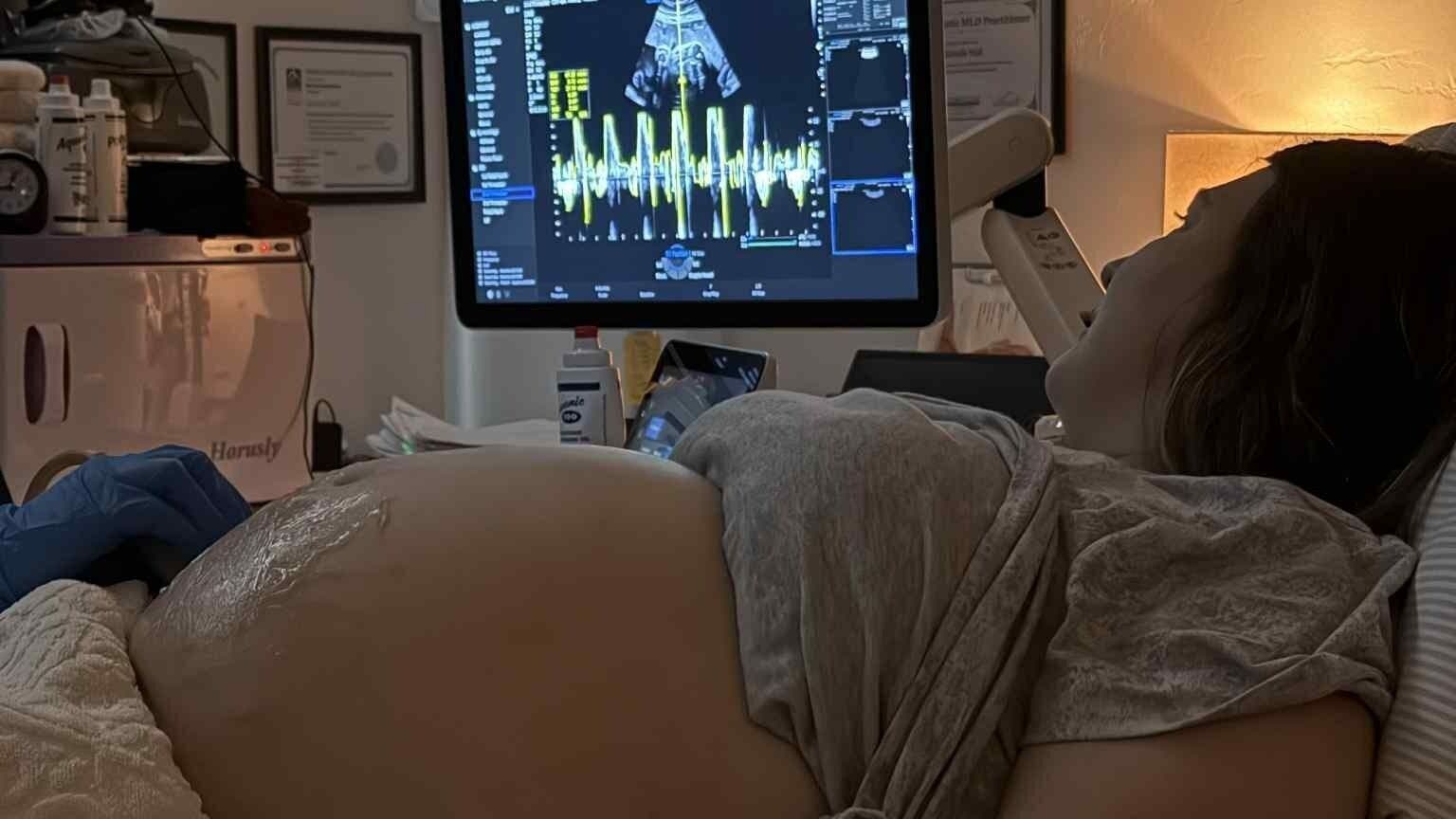 Pregnancy ultrasound at Sunbeam Sonogram, De Pere, Wisconsin, US, displaying sonogram screen.