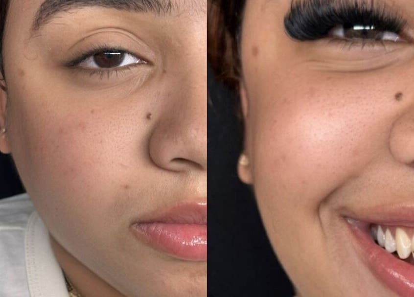 Antes y después de extensiones de pestañas en Cottonlashes, Barcelona, Catalunya, ES. Realza tu mirada.