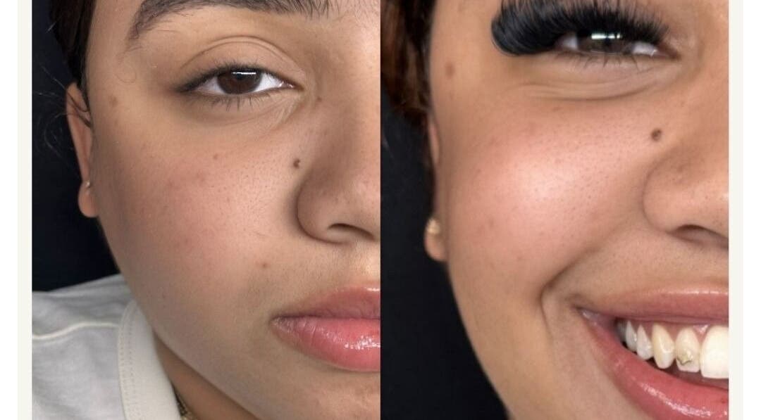 Antes y después de extensiones de pestañas en Cottonlashes, Barcelona, Catalunya, ES. Realza tu mirada.