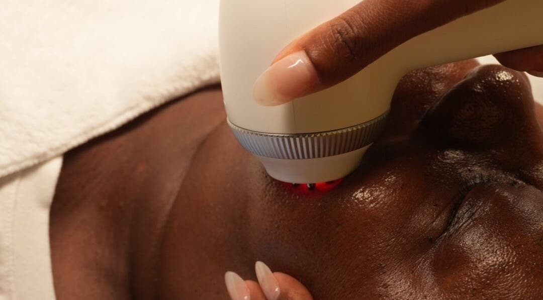 Close-up skin treatment at The Skn Grl in Ajax, Ontario, CA using advanced device.