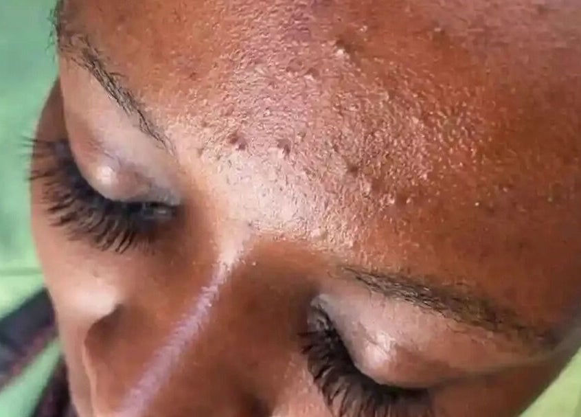 Close-up of a client's radiant skin at Nomsa's beauty salon, Vanderbijlpark, Gauteng, ZA.