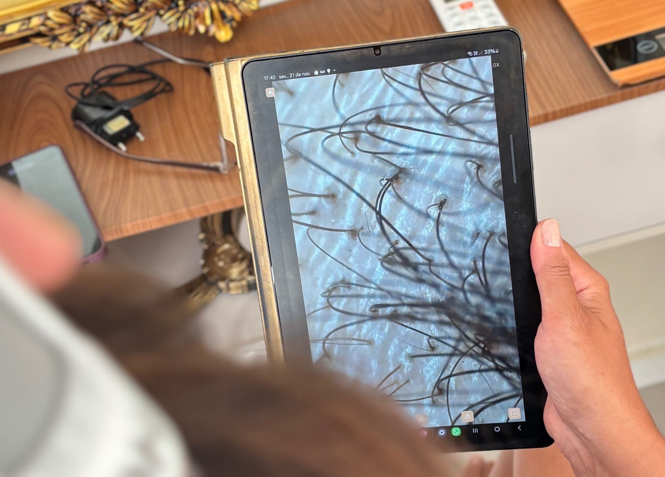 Análise de cabelo em tablet no Atelliê 28, Santa Catarina, Santa Catarina, BR.