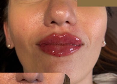 Close-up of glossy lips post-treatment at Faces by MR - Garforth, Garforth, England, GB.