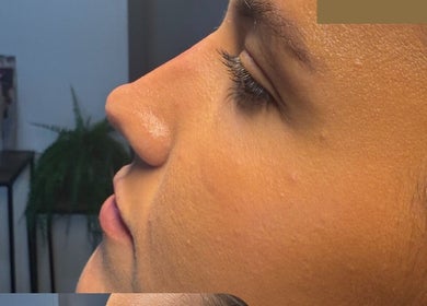 Profile view of a woman's face showcasing skincare at Faces by MR - Garforth, Garforth, England, GB.