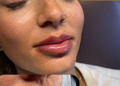 Close-up of glossy lips after treatment at Faces by MR - Wetherby, located in Wetherby, England, GB.
