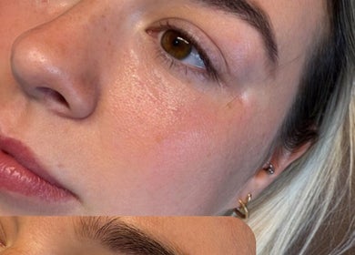 Close-up of glowing skin treatment at Faces by MR - Wetherby, showcasing clear complexion. Wetherby, England, GB.