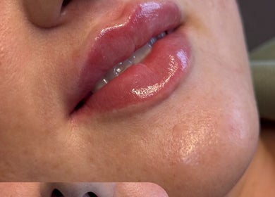 Close-up of glossy lips treatment at Faces by MR - Wetherby, enhancing natural beauty in Wetherby, England, GB.