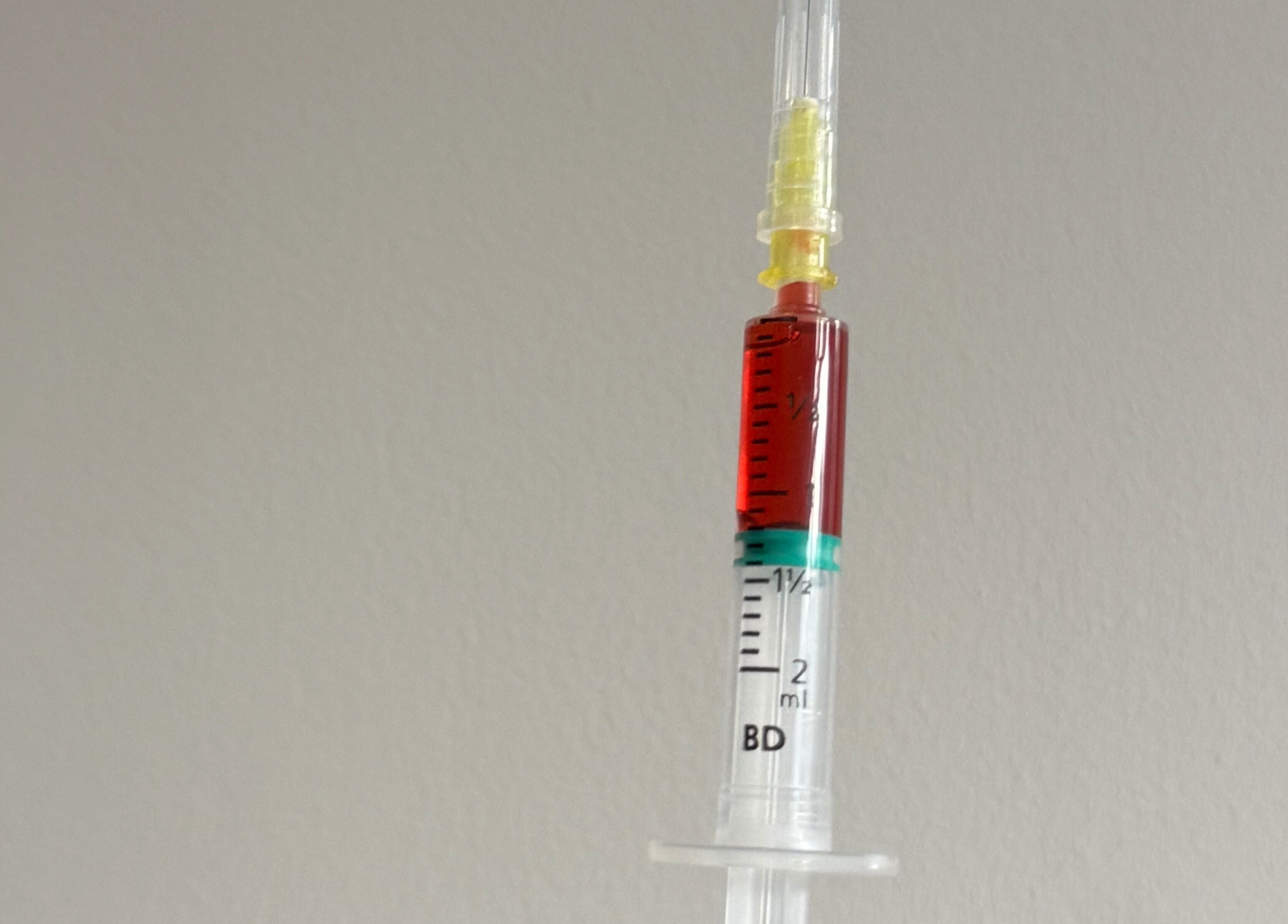 Close-up of a filled syringe, symbolizing treatments at Re.scalp, Birmingham, England, GB.