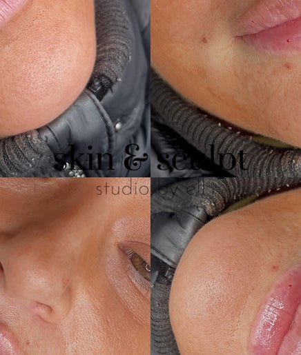 Closeup of rejuvenated skin at Skin and Sculpt Studio by Ell, Poulton-le-Fylde, England, GB.