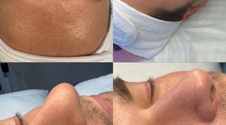 Procedimento de cuidados faciais realizado no Samy Nunes, Cascais, Lisboa, PT, destacando a pele saudável.