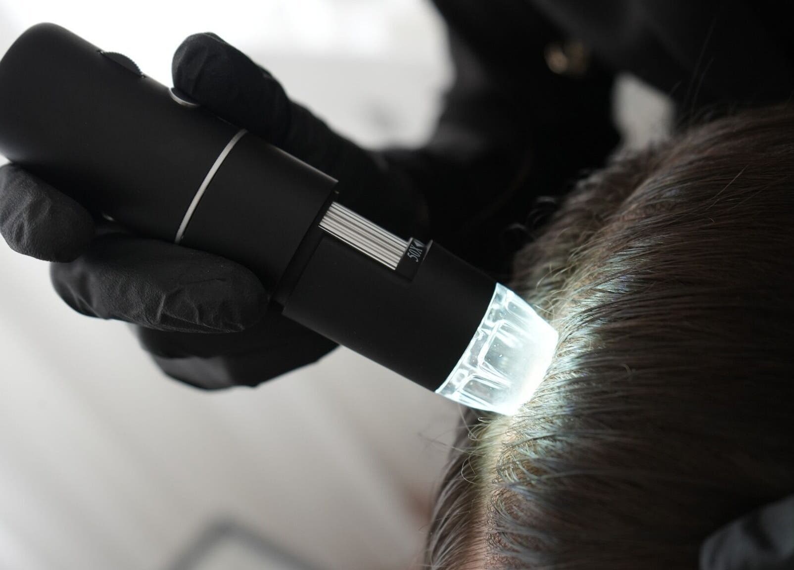 Kontrola pokožky hlavy v Esthé Institute Kladno, Kladno, Středočeský Kraj, CZ s moderní technologií.