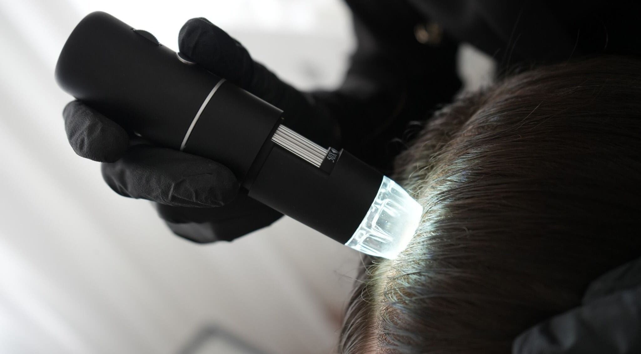 Kontrola pokožky hlavy v Esthé Institute Kladno, Kladno, Středočeský Kraj, CZ s moderní technologií.