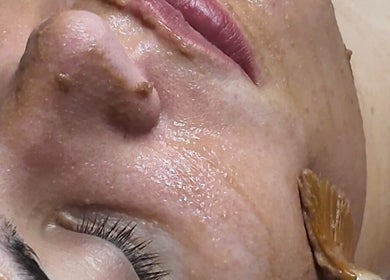 Facial treatment at Signature Skin, Little Massingham, England, GB enhancing skin radiance.