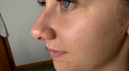 Close-up of smooth, radiant skin showcasing beauty treatment at Beauty By Becca, Portlethen, Scotland, GB.