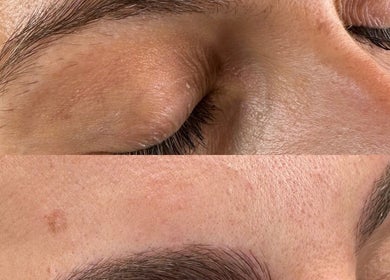 Detailed eyebrow shape refinement at Young Cosmetics, Luton, England, GB. Before and after transformation visible.