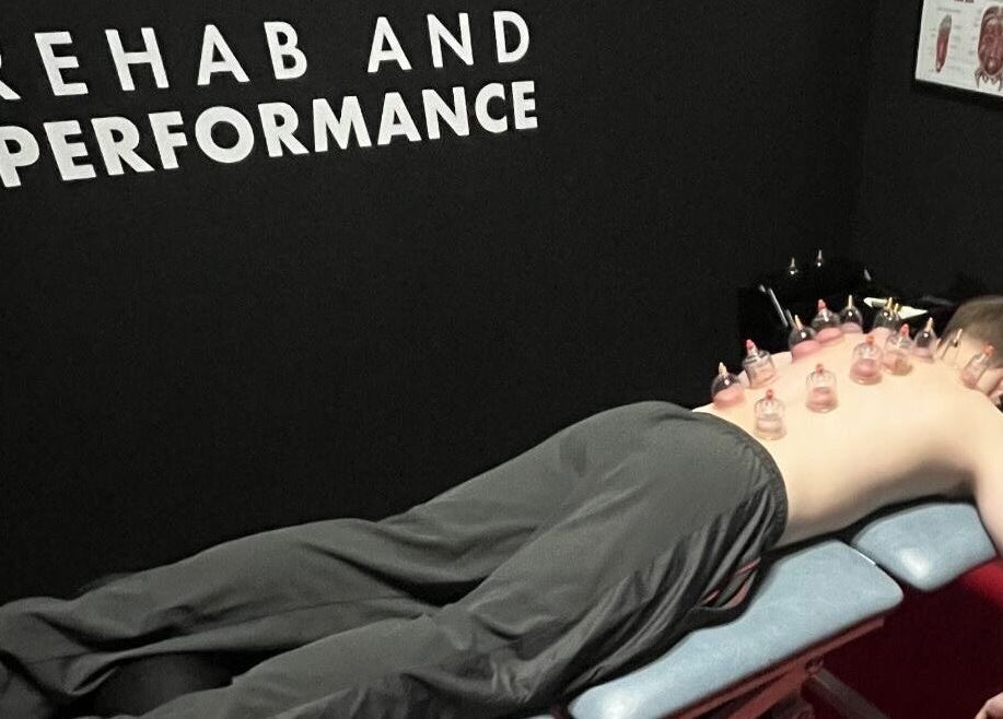 Cupping therapy session at T.N Sport Therapy, Llanelli, Wales, GB, enhancing rehab and performance.
