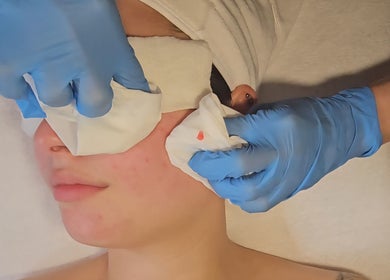 Expert facial care at Joro Studio in Melbourne, Victoria, AU enhances skin health and relaxation.