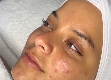 Relaxed client enjoying a facial at Rebecca Louise Beauty, Culcheth, England, GB. Focus on calmness and rejuvenation.
