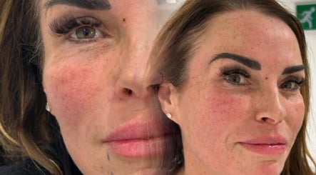 Close-up of a woman's rejuvenated skin at KINGS AESTHETICS TRAINING ACADEMY, Ashton-in-makerfield, England, GB.