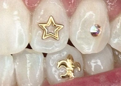 Shimmering tooth gems at HR Beauty & Spa, Fairfield Heights, New South Wales, AU for a unique dental style.
