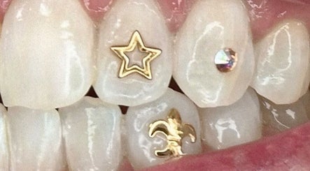 Shimmering tooth gems at HR Beauty & Spa, Fairfield Heights, New South Wales, AU for a unique dental style.
