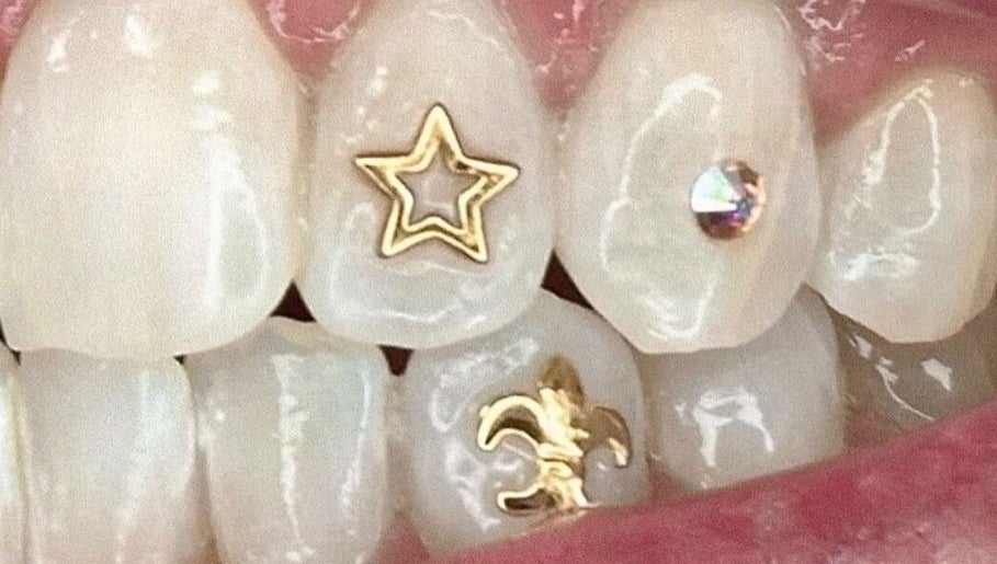 Stylish teeth jewelry at HR Beauty & Spa in Fairfield Heights, New South Wales, AU.