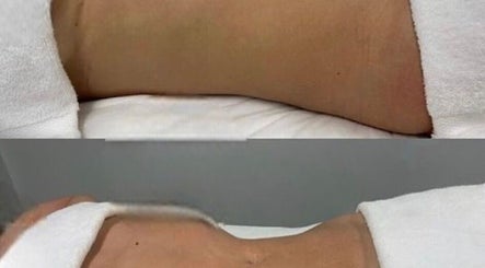 Body contouring results at Sculptmebyjord, Loughton, England, GB. Effective wellness transformation.