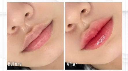 Hình ảnh trước và sau dịch vụ chăm sóc môi tại Master Vũ Vương - Beauty Academy, Hồ Chí Minh, VN.